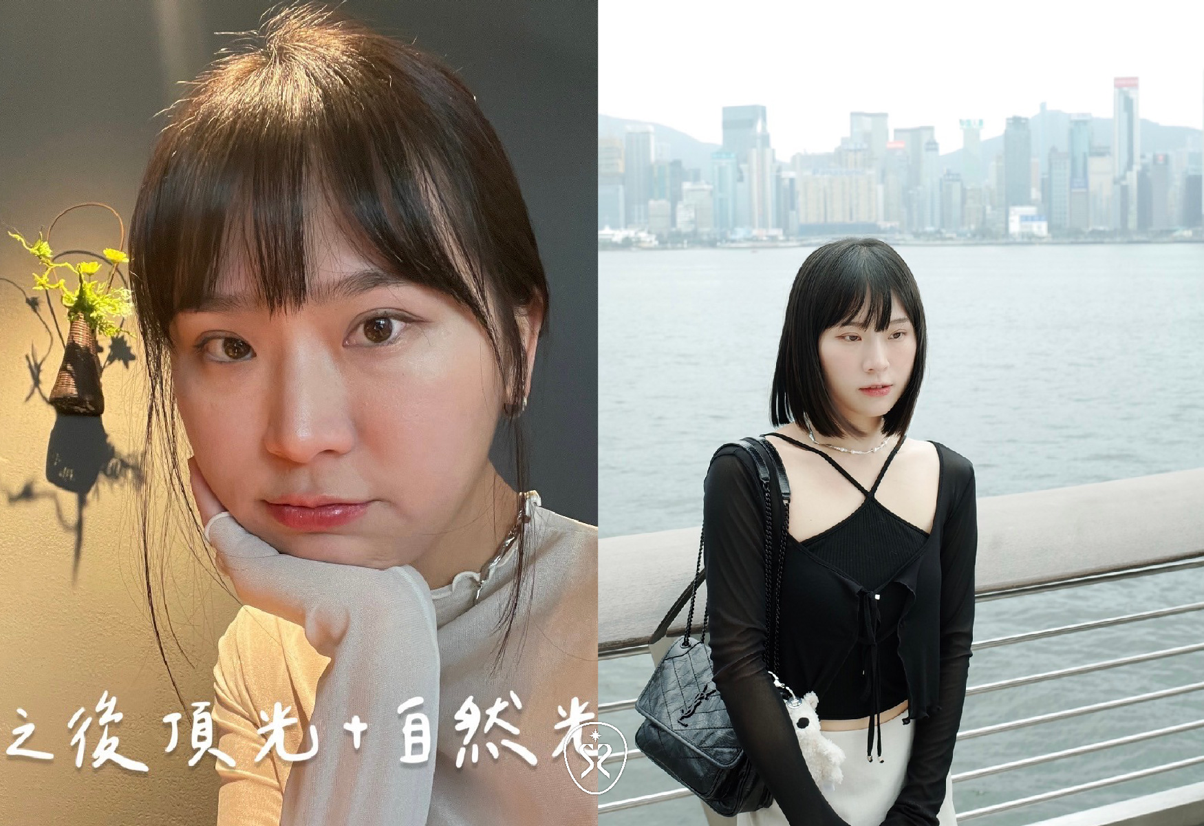 自強星和診所竹北-薇貝拉填補自然好氣色
